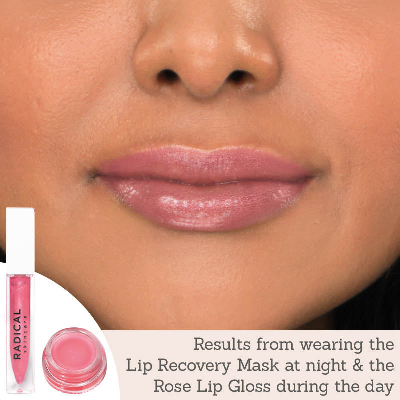 Radical Skincare Lip Recovery Mask and Rose Lip Luster Gloss Duo results