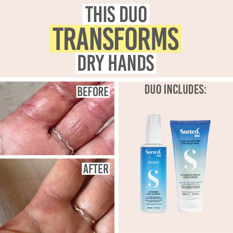 Sorted Skin Intensive Rescue Spray and Moisturiser Duo - Beauty and the Boutique - This duo transforms dry hands